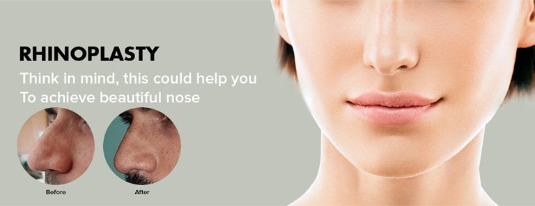 rhinoplasty surgery in India