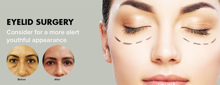 eyelid surgeon in Delhi