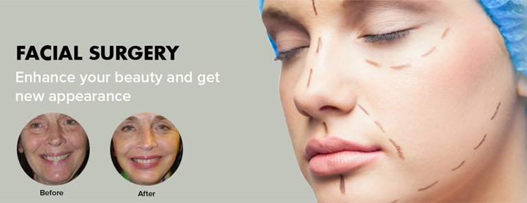 facelift surgery in India